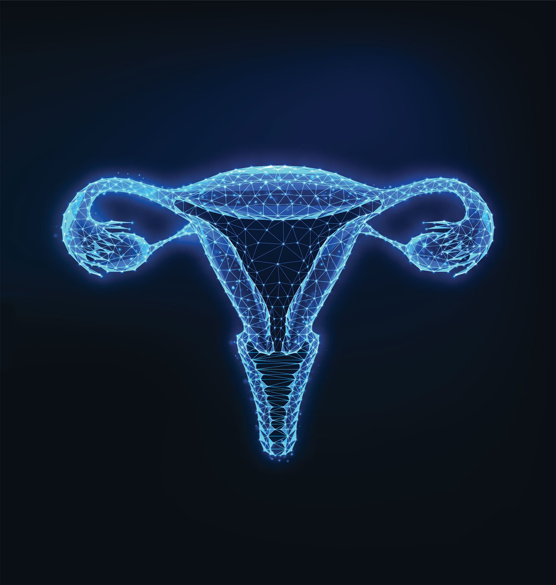 Ovarian Cancer